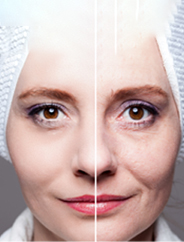 ANTI-AGING right banner